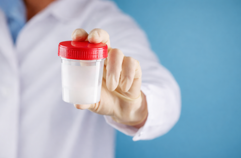 Causes of No Sperm in Semen